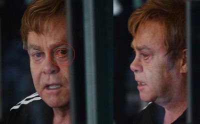 Elton Con şok görüntüler