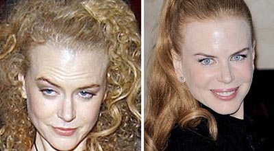 Nikol Kidman etiraf etdi