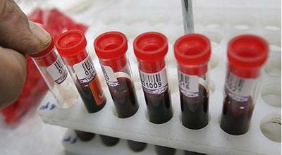 QİÇS (AIDS) xəstəliyinin müalicəsi tapılır?