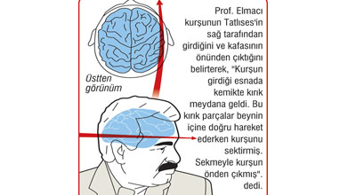 Güllə Tatlısəsin başına belə dəydi