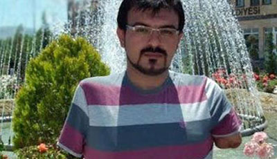 Türkiyədə orqan köçürülən xəstə öldü